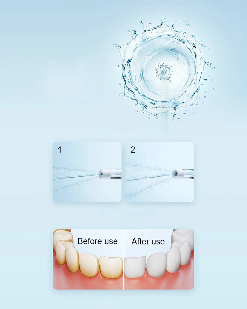XIAOMI MIJIA-irrigador Oral portátil F300, irrigador Dental con chorro de agua, blanqueamiento Dental, limpiador de dientes bucales, pulso de agua MEO703