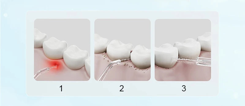 XIAOMI MIJIA-irrigador Oral portátil F300, irrigador Dental con chorro de agua, blanqueamiento Dental, limpiador de dientes bucales, pulso de agua MEO703